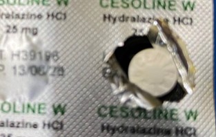 HDLZ (25 mg)